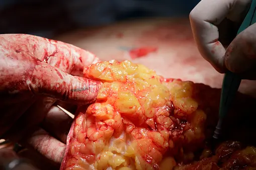 Natural ingredients collection displayed beautifully